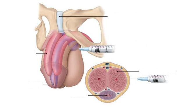 Injections to improve potency